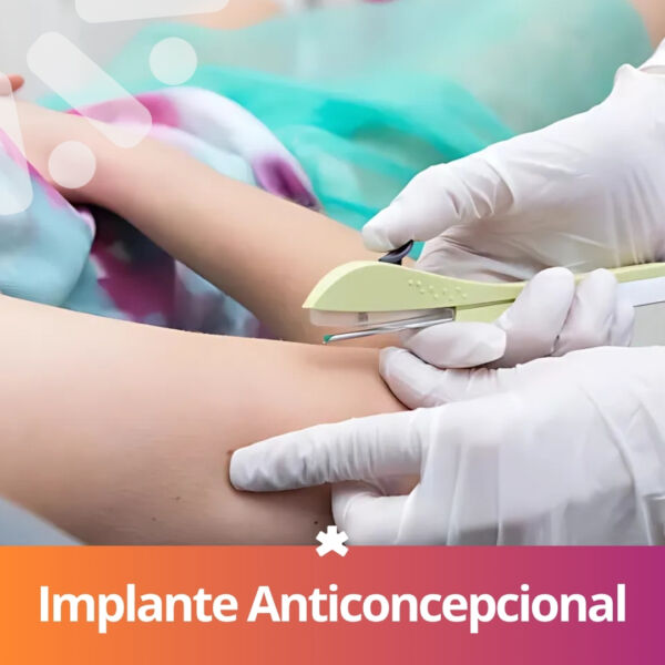 Implante Anticoncepcional Implanon