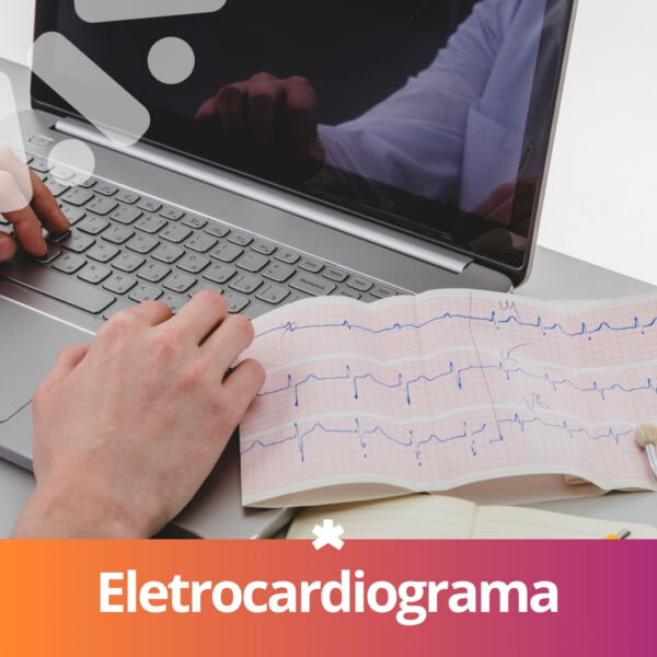 Eletrocardiograma