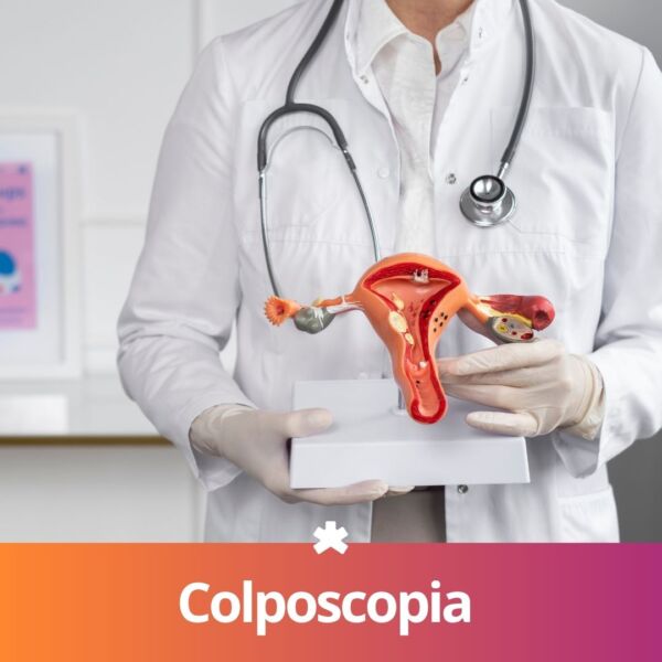Colposcopia